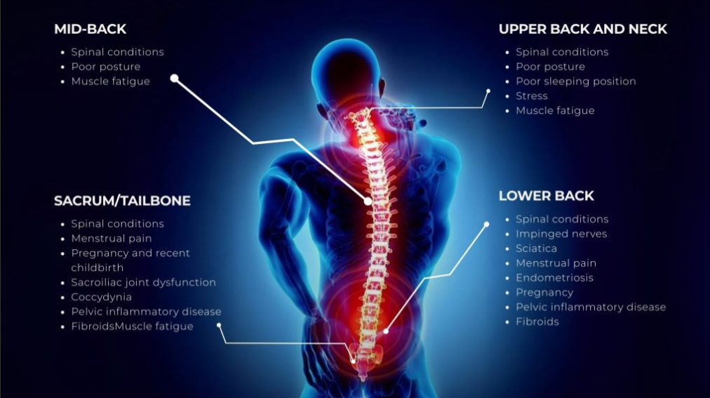 Do You Really Need an MRI for Back Pain? A Physiotherapist Explains